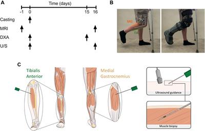 Atrophy Resistant vs. Atrophy Susceptible Skeletal Muscles: “aRaS” as a Novel Experimental Paradigm to Study the Mechanisms of Human Disuse Atrophy